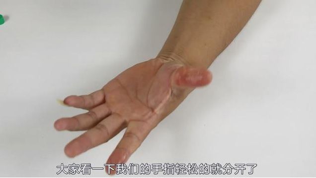 502胶水把手黏住了怎么办